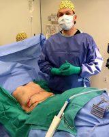 Body Makeover Surgery Photo By Doctor David Janssen, MD, FACS, Oshkosh Plastic Surgeon