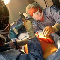 Doctor Bradley A. Hubbard, MD, Dallas Plastic Surgeon Mommy Body Makeover
