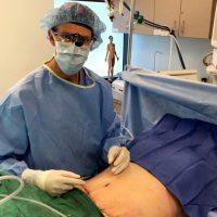 Tummy Tuck Vs Liposuction With Dr Steven Vath, MD, Denver Plastic Surgeon